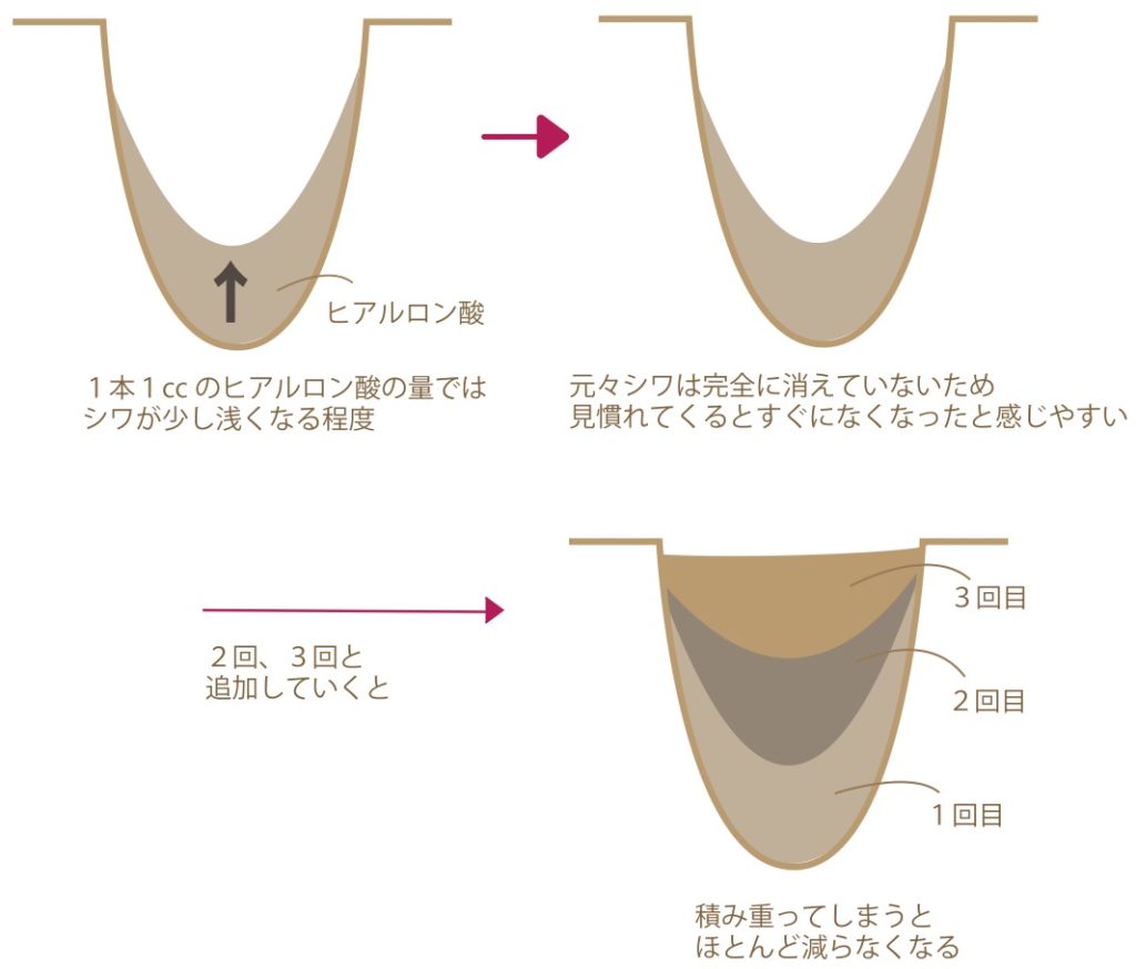 ヒアルロン酸が蓄積される図2