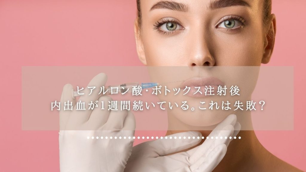ヒアルロン酸・ボトックス注射後内出血が１週間続いている。これは失敗？