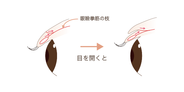 二重手術の解剖図