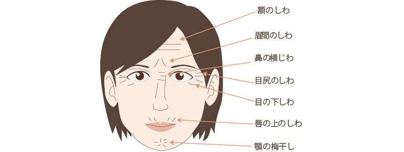 ボトックス注射が可能な部位