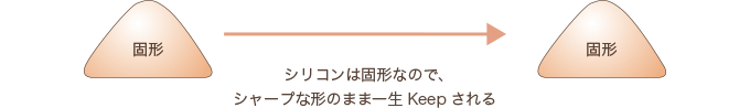 鼻のプロテーゼはシャープな形のまま一生keepされる