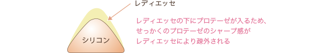 プロテーゼの上からレディエッセを注入したイラスト