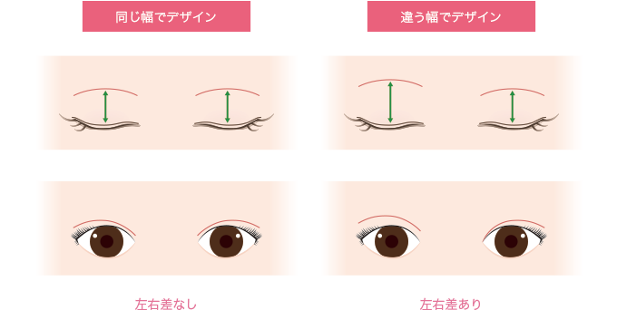 左右差なしと左右差ありのイラスト