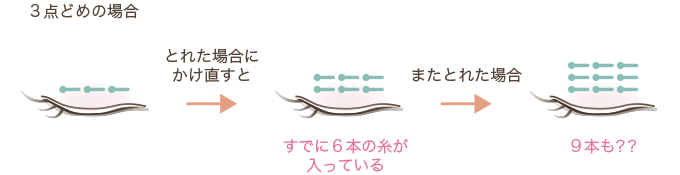 二重埋没法3点留めの場合