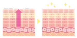 ピーリングイメージイラスト