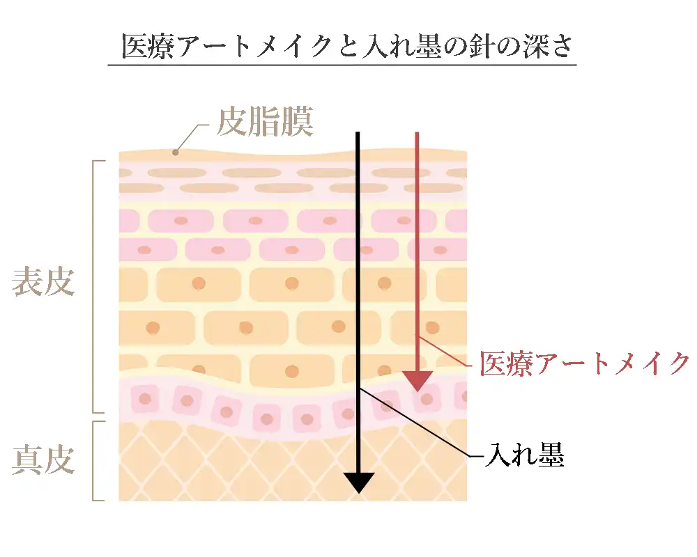 医療アートメイクと入れ墨の違い