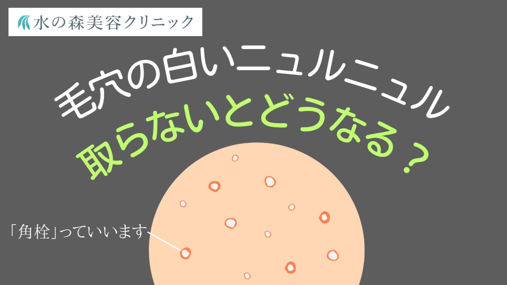 角栓広告汚い: 角栓広告 詐欺 – BGFCID