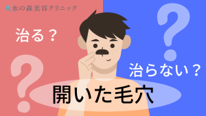 毛穴の開きは改善できる？原因や最適な治療法について解説