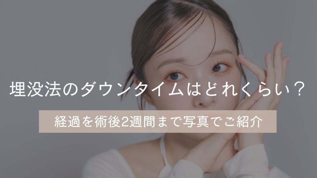 埋没法のダウンタイムはどれくらい?経過を術後2週間まで写真でご紹介
