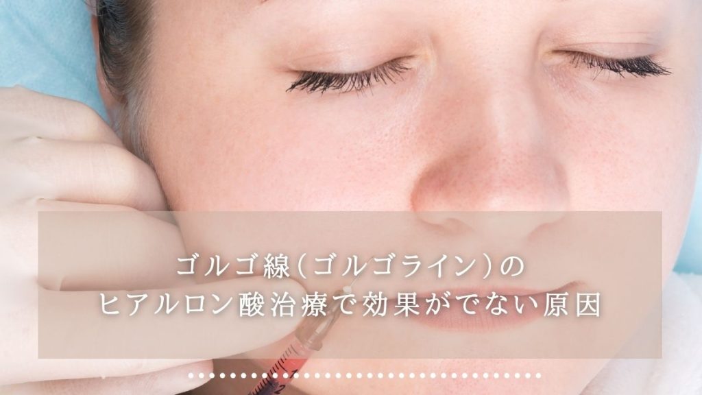 ゴルゴ線（ゴルゴライン）のヒアルロン酸治療で効果がでない原因