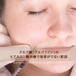 ゴルゴ線（ゴルゴライン）のヒアルロン酸治療で効果がでない原因