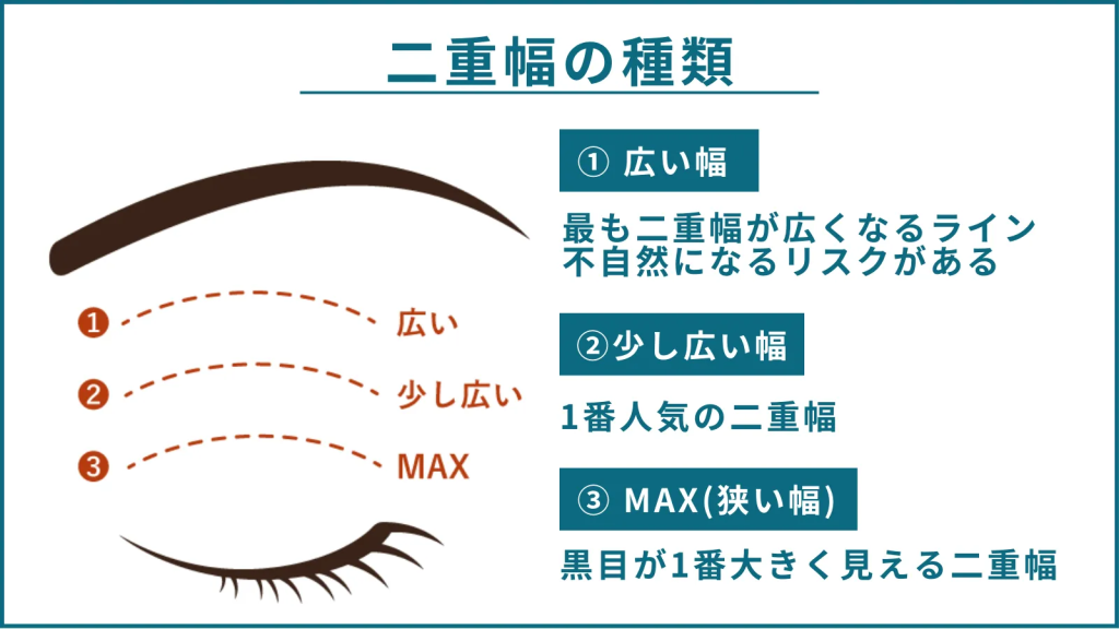 二重幅の種類