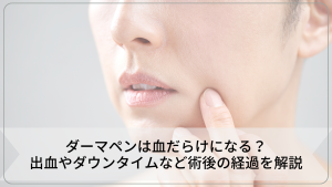 ダーマペンは血だらけになる？出血やダウンタイムなど術後の経過を解説