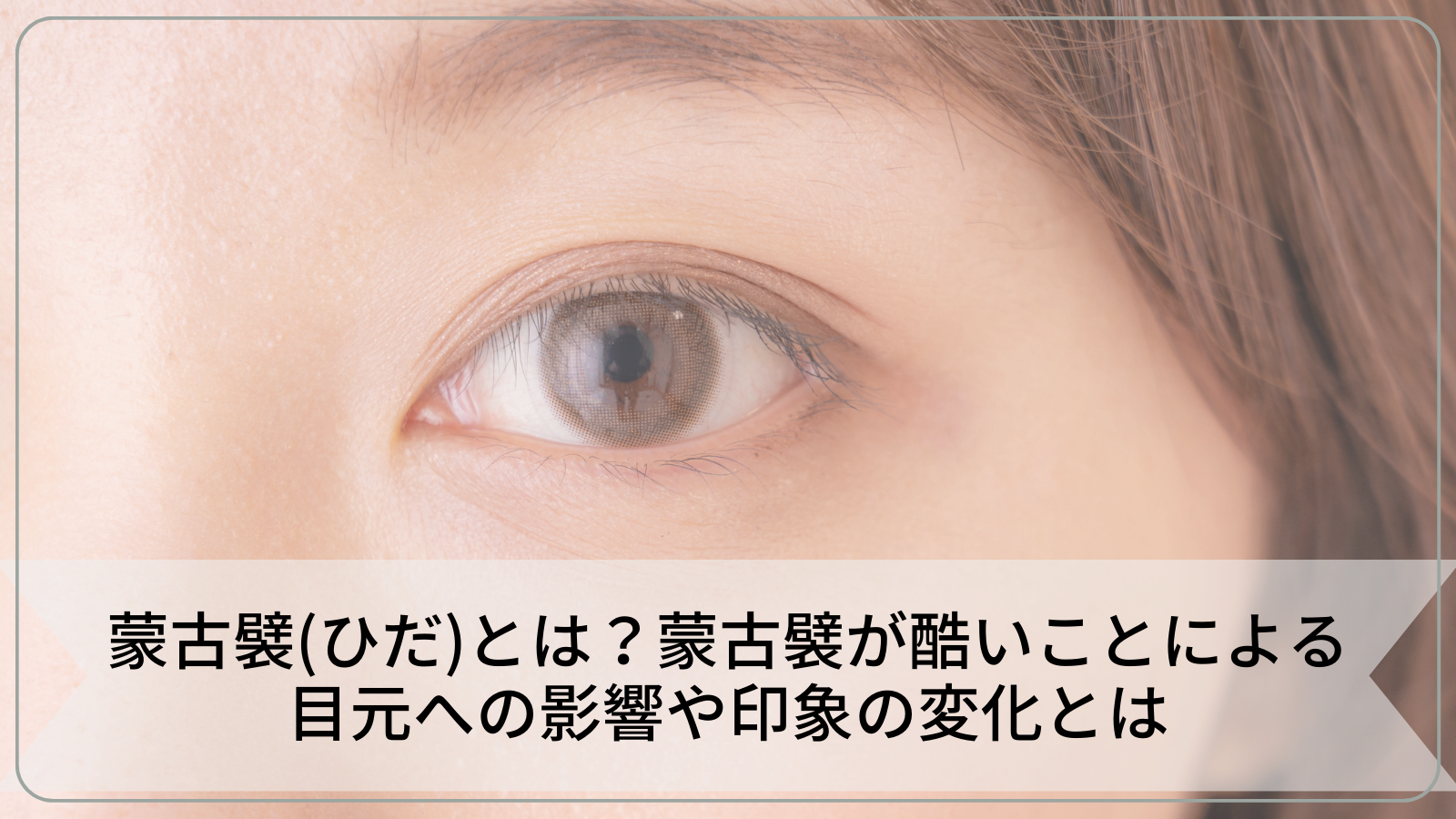 蒙古襞（ひだ）とは？蒙古襞が酷いことによる目元への影響や印象の変化とは
