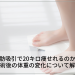 脂肪吸引で20キロ痩せれるのか？施術後の体重の変化について解説