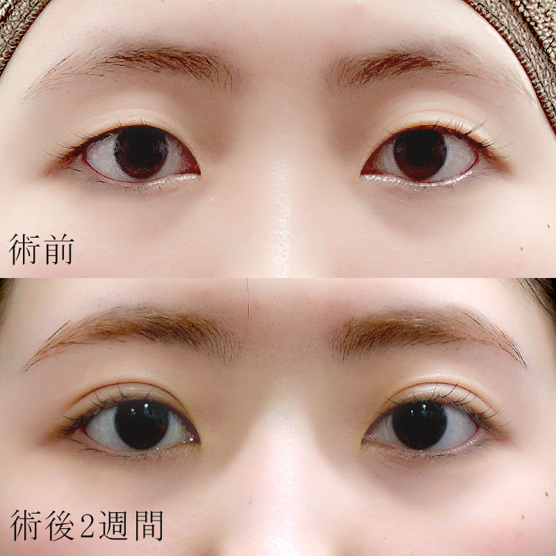 症例写真