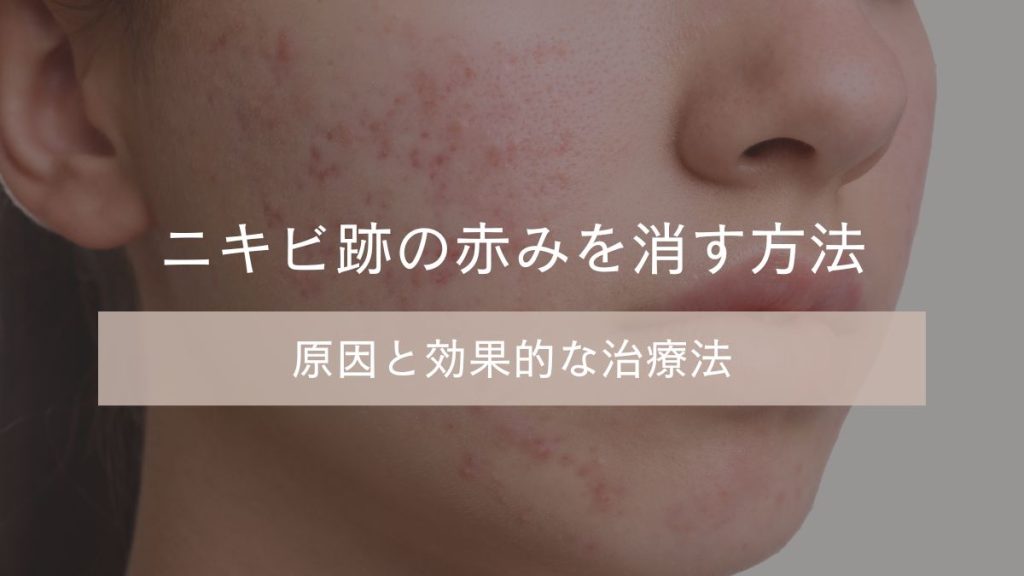 ニキビ跡の赤みを消す方法