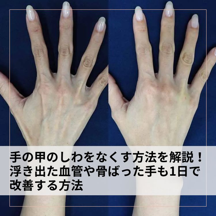 手の甲のしわをなくす方法を解説！浮き出た血管や骨ばった手も1日で改善する方法