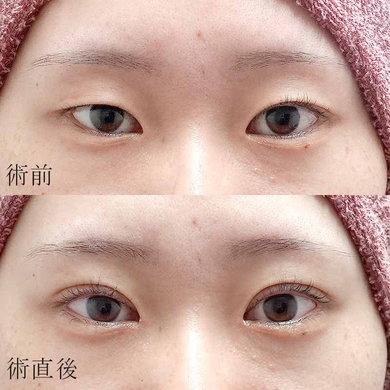 小野医師の症例写真②