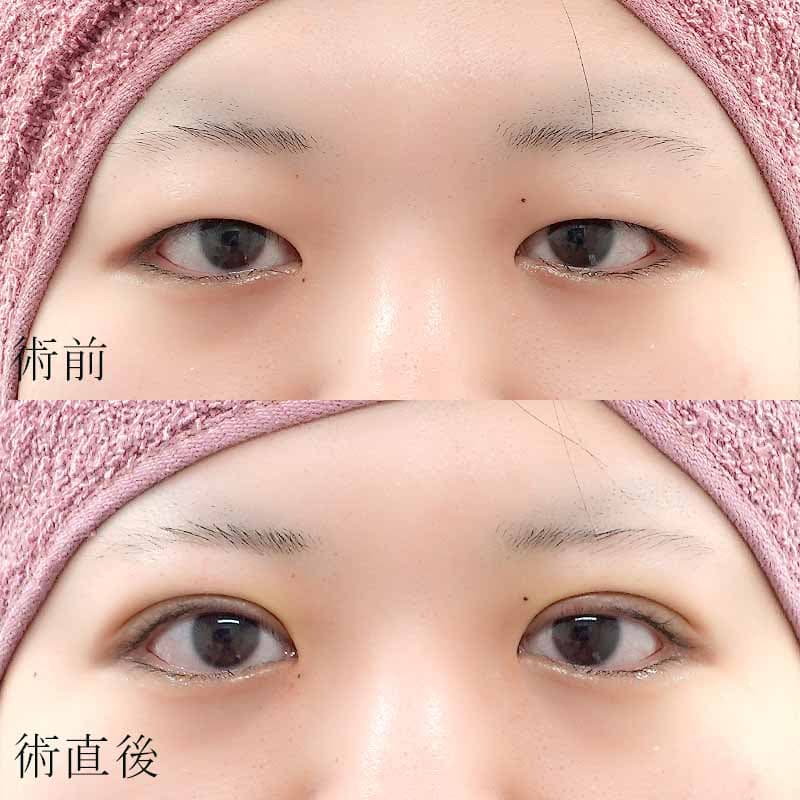 小野医師の症例写真①