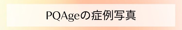 PQAge の症例写真