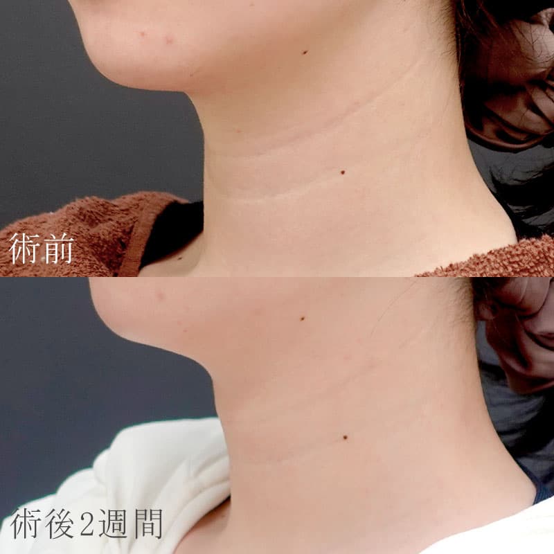 執刀医：藤田医師