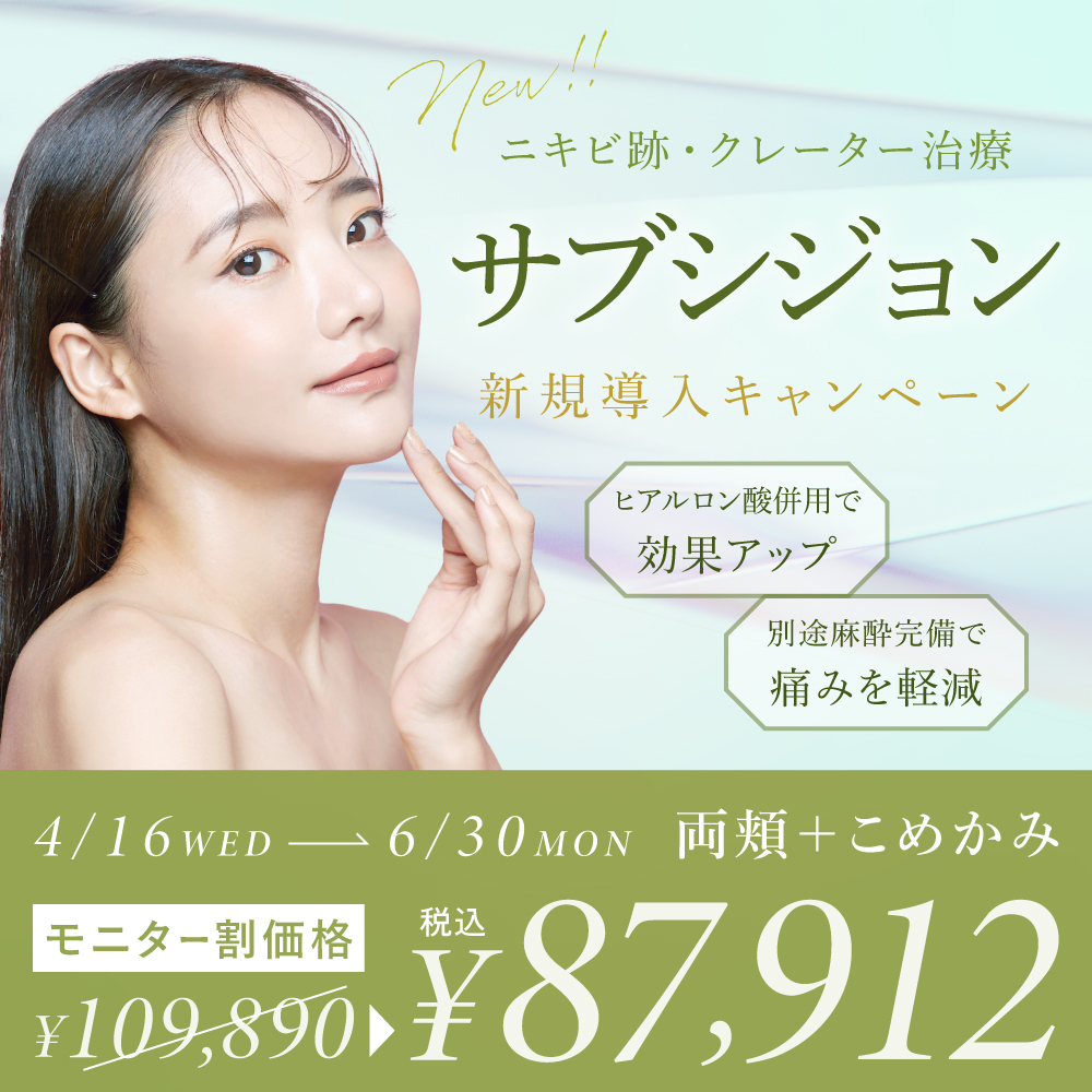 【NEW】ニキビ跡・クレーター治療におすすめ！サブシジョン新規導入キャンペーン【名古屋院・銀座院】
