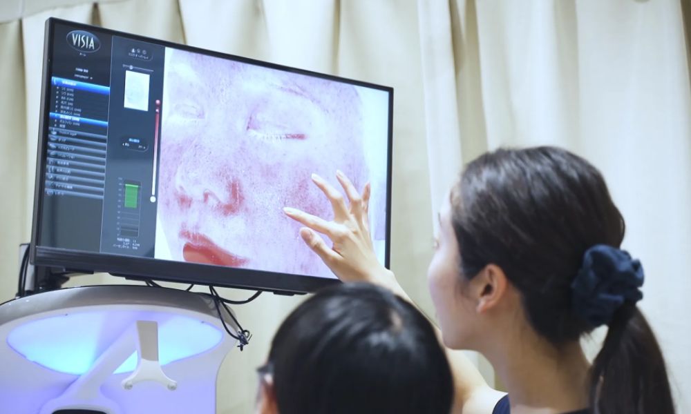 肌診断の様子