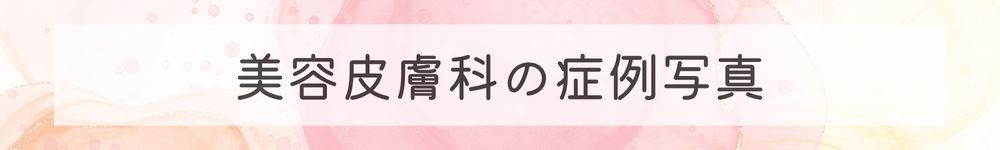 美容皮膚科の症例写真