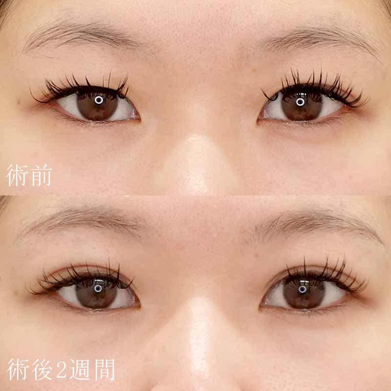 細野医師の症例写真