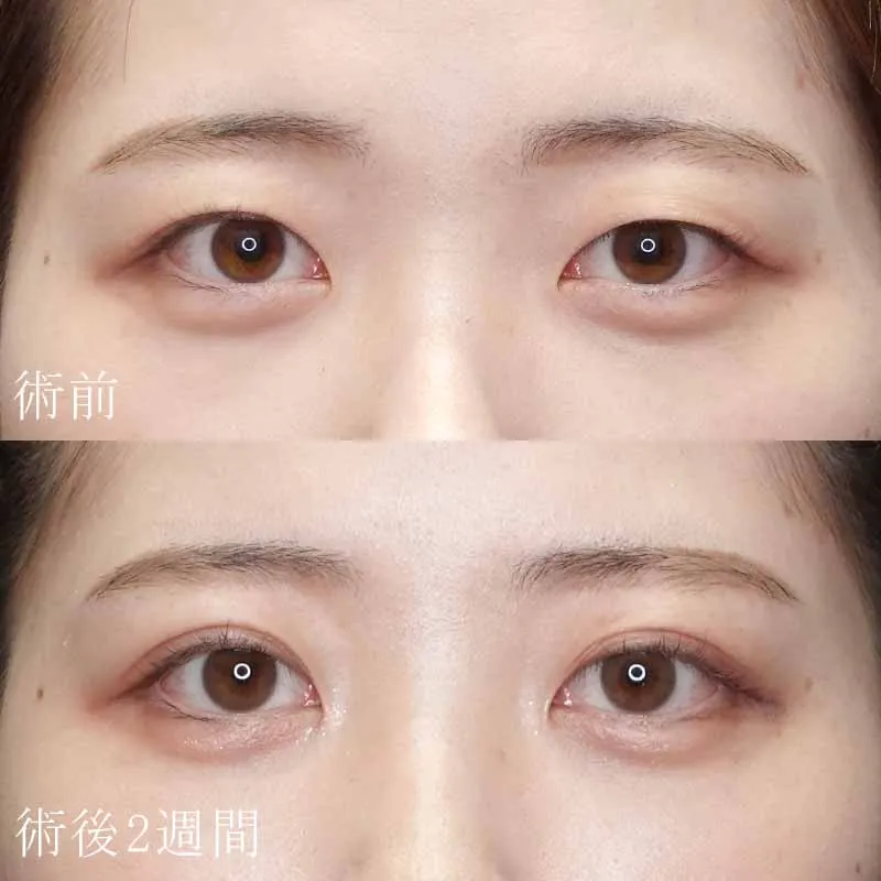 症例写真