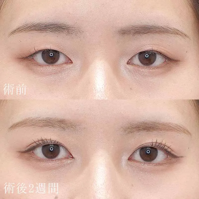 症例写真