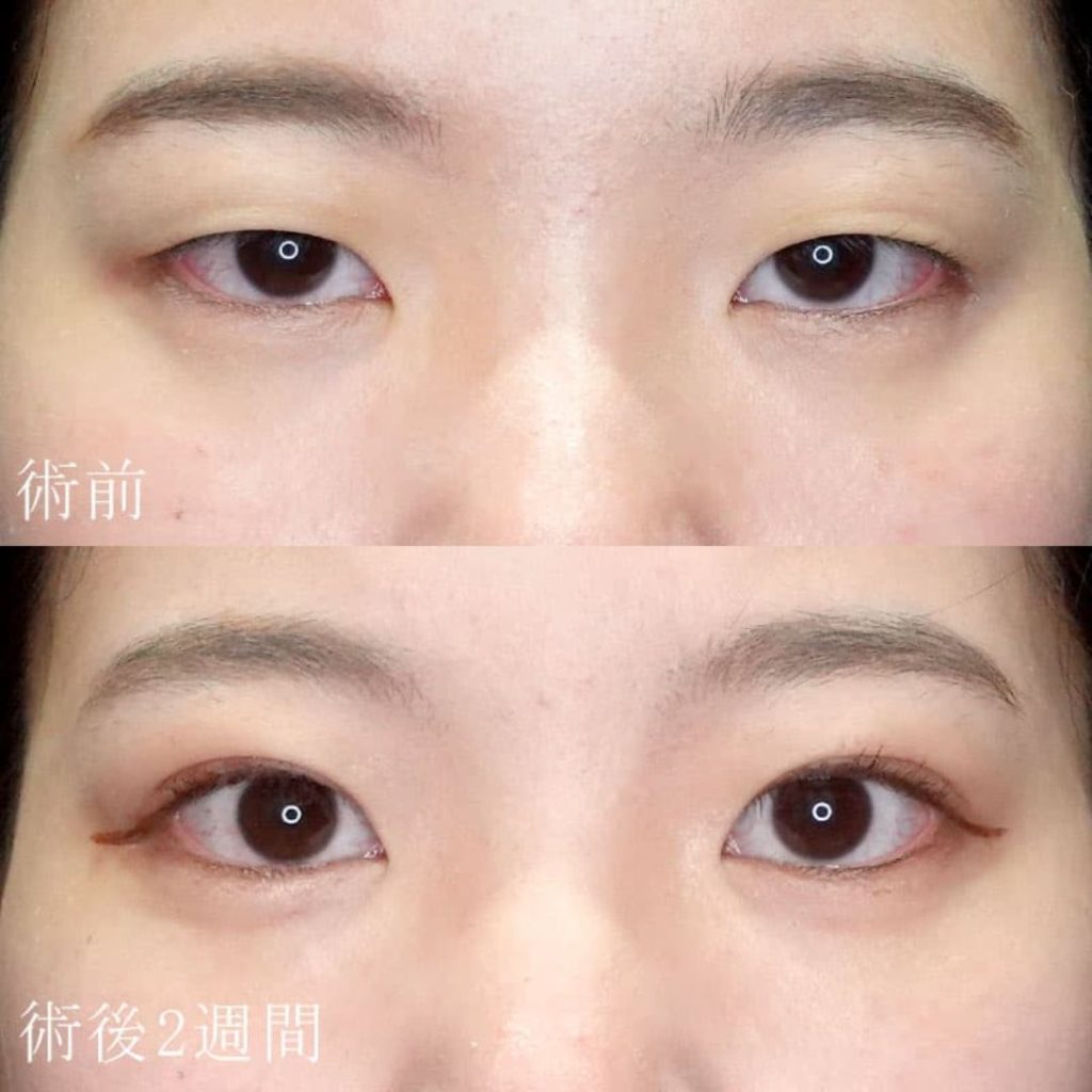 常盤医師の症例写真