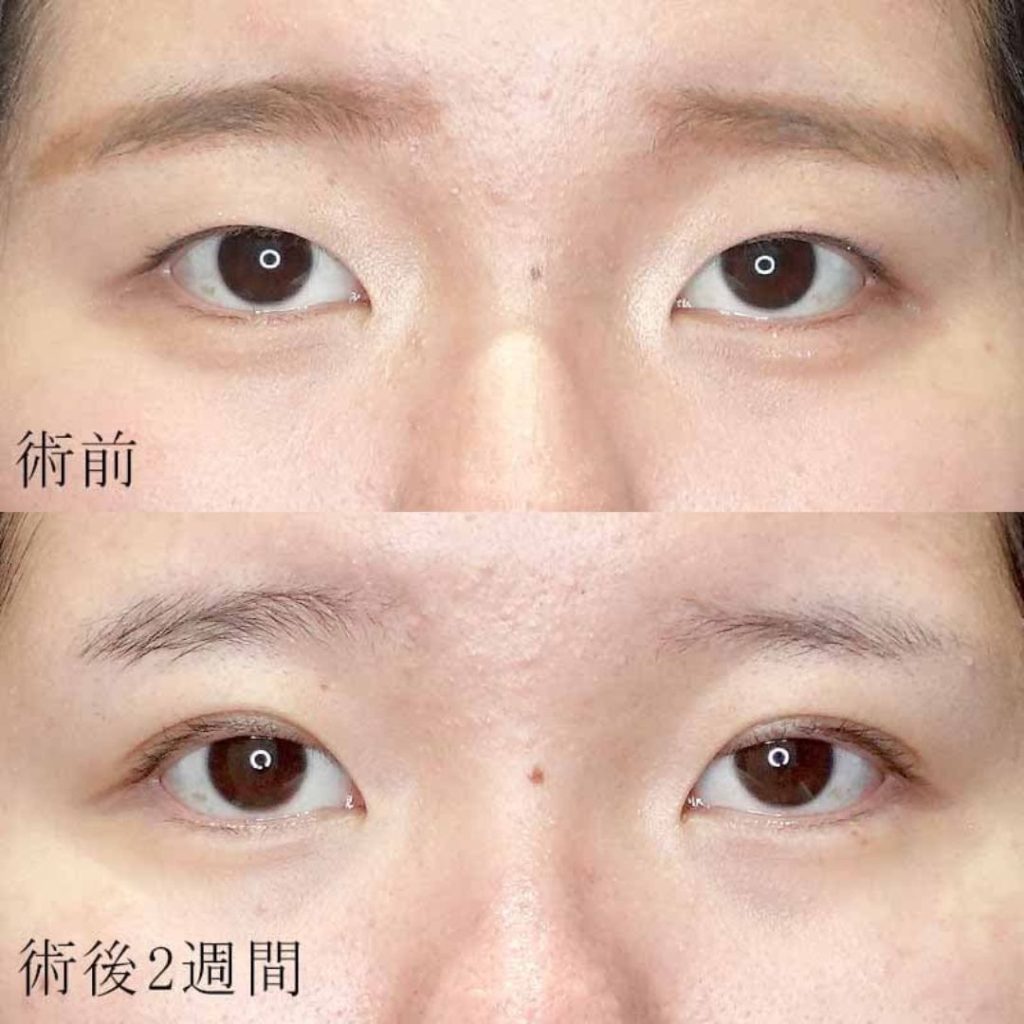 杉山医師の症例写真