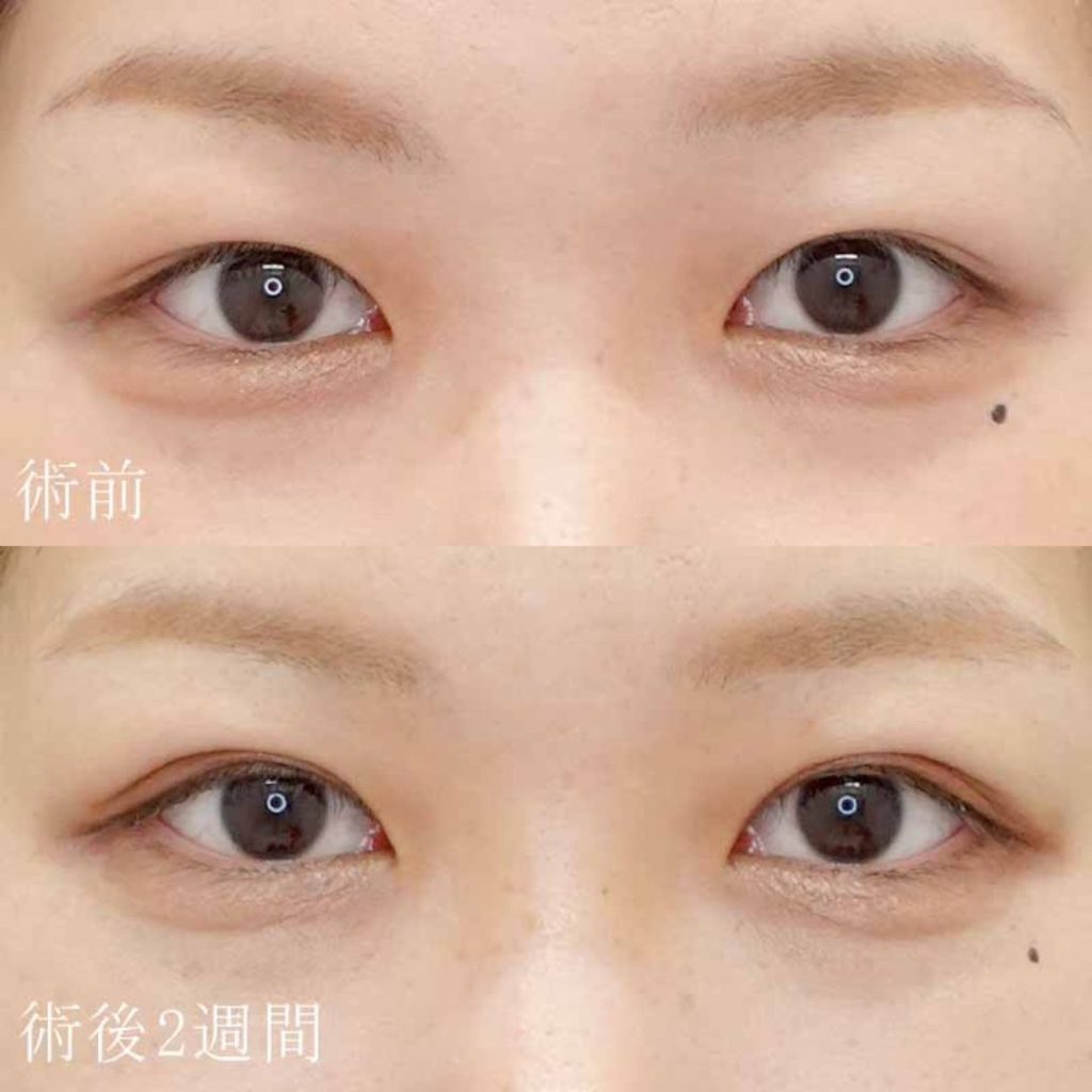 細野医師の症例写真