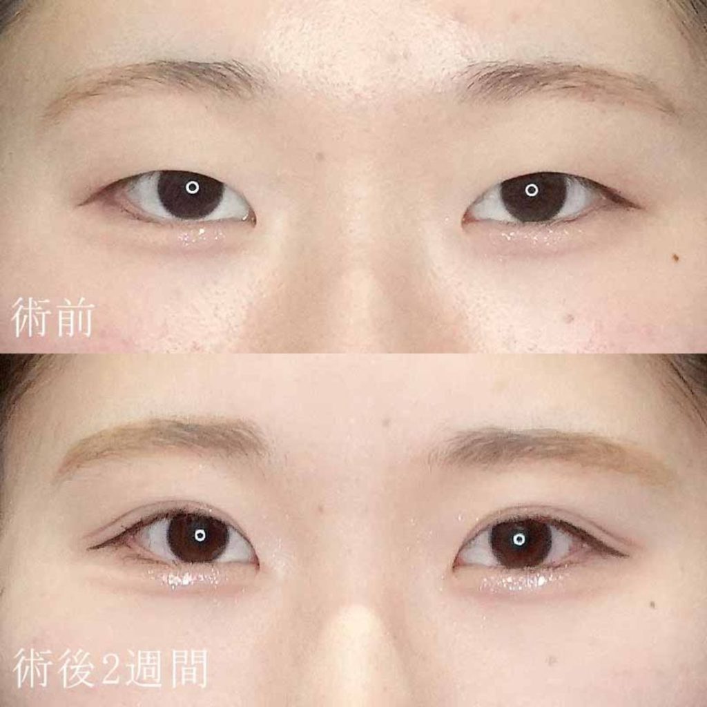 門屋医師の症例写真