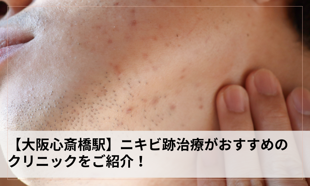 タイトル画像
