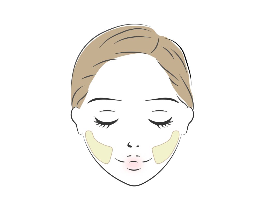 バッカルファット