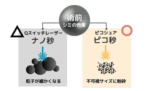 ピコレーザーと他レーザー治療との違い