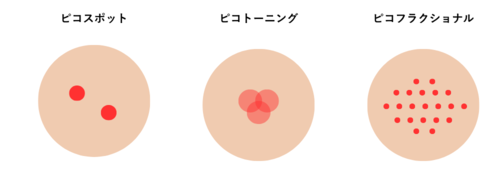 ピコレーザー照射モードイメージ