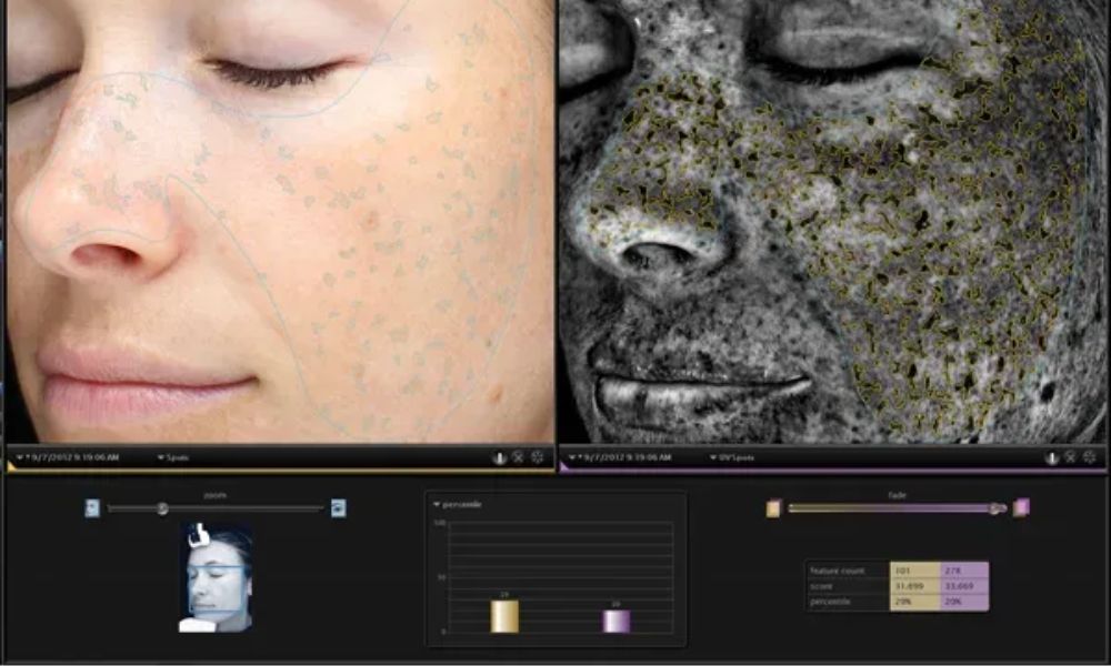 肌診断機のデータ