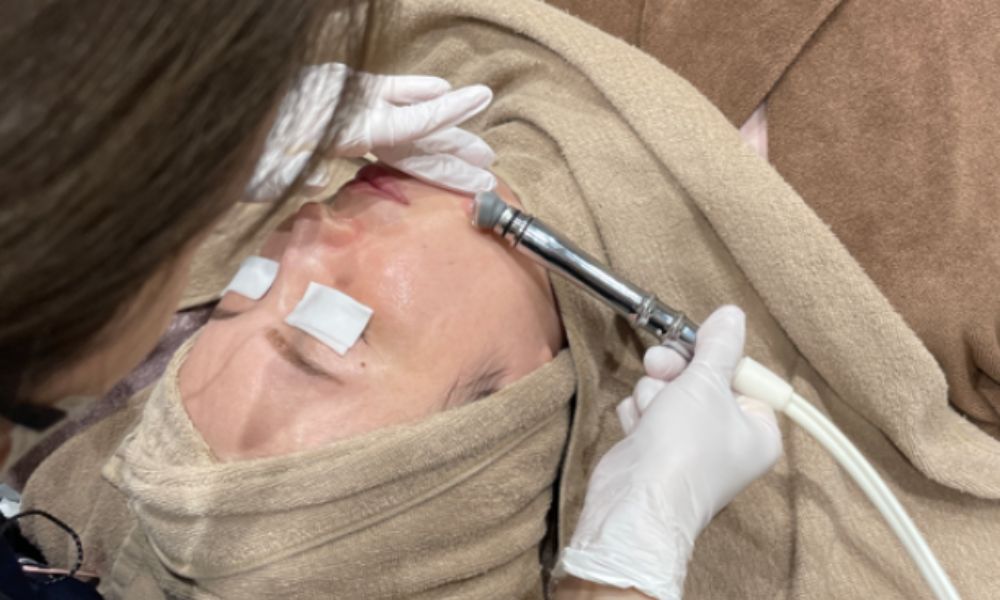 ウォーターピーリングの施術の様子