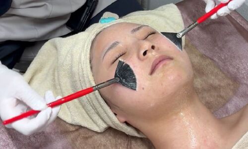 ララドクターの施術の様子