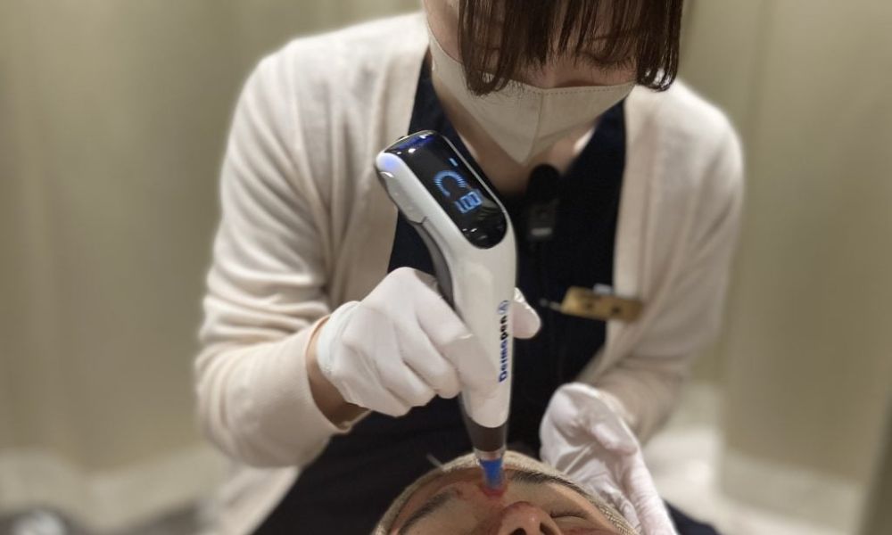 美容皮膚科施術の様子