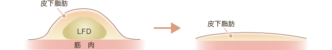 脂肪イラスト③