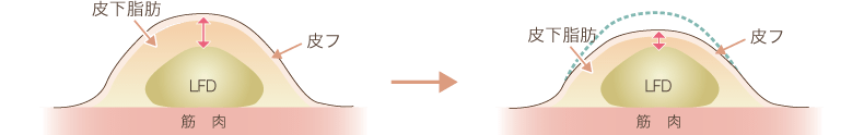 脂肪イラスト②