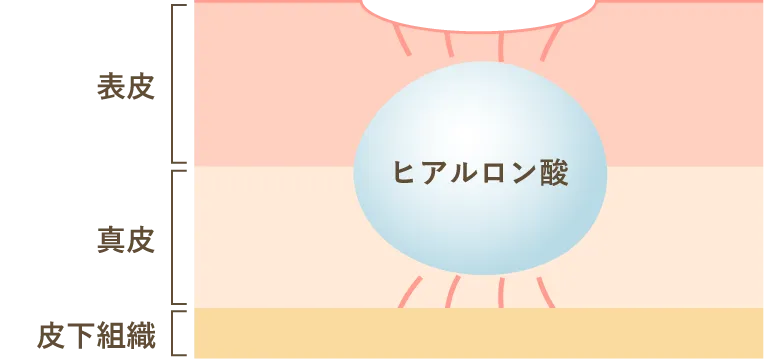ヒアルロン酸の効果