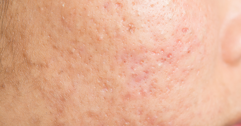 クレーターの写真