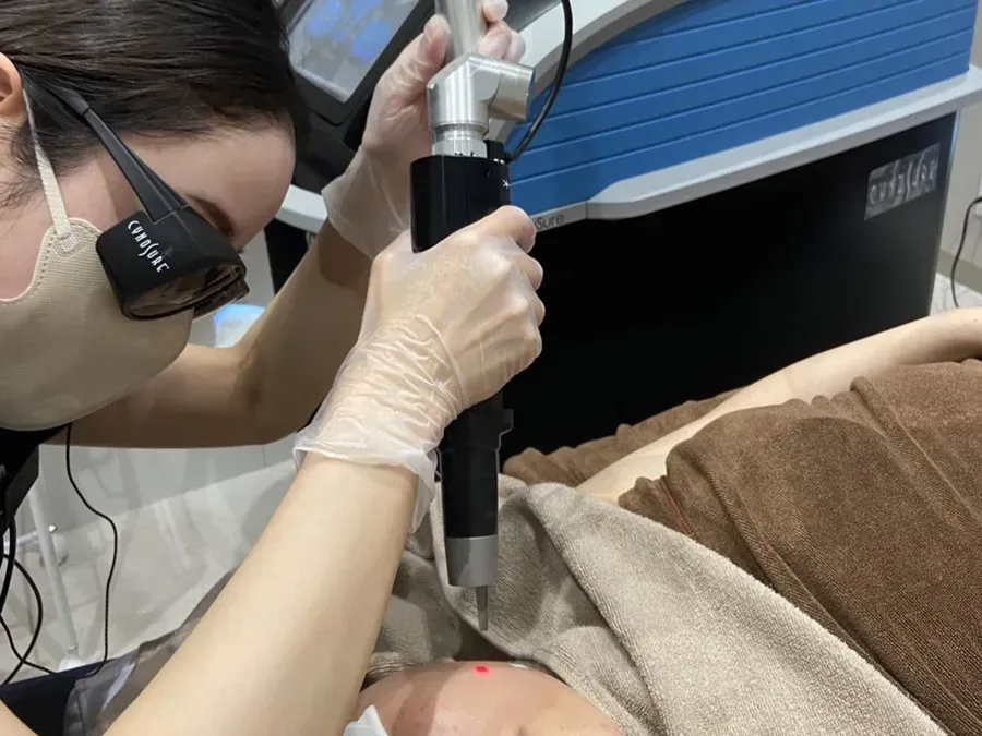 ピコフラクショナル