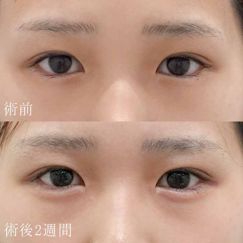 執刀医：小糸医師